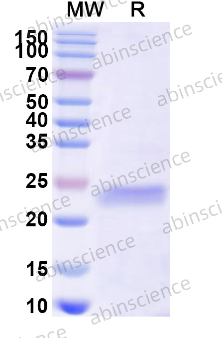 BoHV-1 gE/Glycoprotein E Recombinant Protein (N-His)