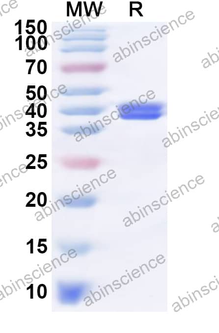 Recombinant BDBV Nucleoprotein, N-His