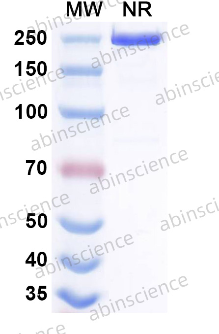Anti-BDBV Nucleoprotein Antibody (SAA2994)