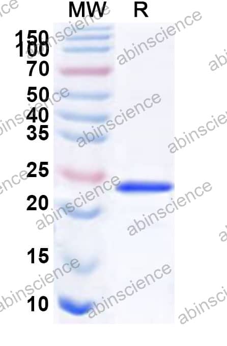 CBoV Nucleoprotein Recombinant Protein (N-His)