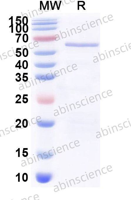 CBoV VP1 Recombinant Protein (N-His)