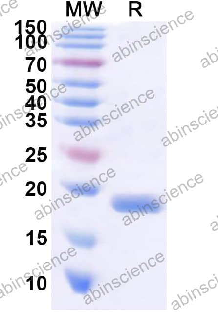CPXV CPXV187 Recombinant Protein (N-His)
