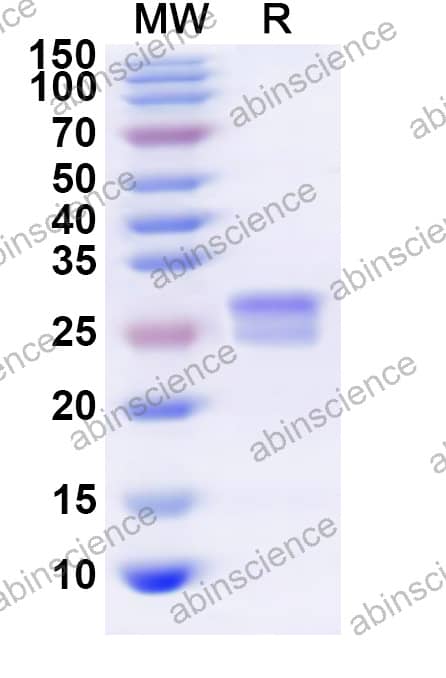 CPXV CPXV203 Recombinant Protein (N-His)