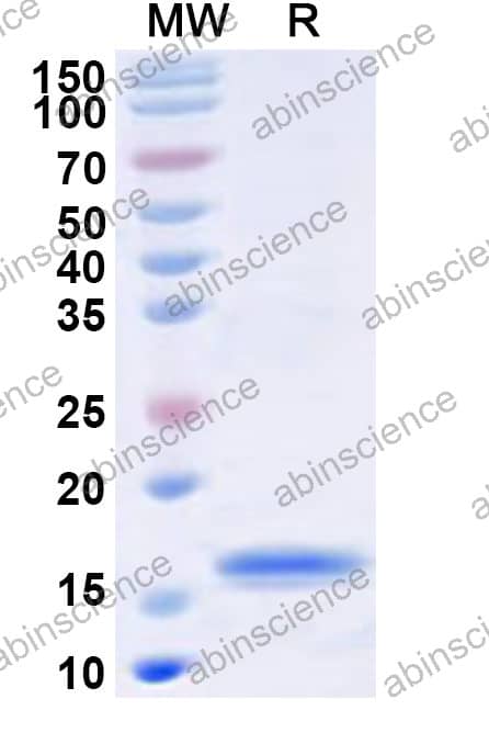 CPXV CPXV208 Recombinant Protein (N-His)
