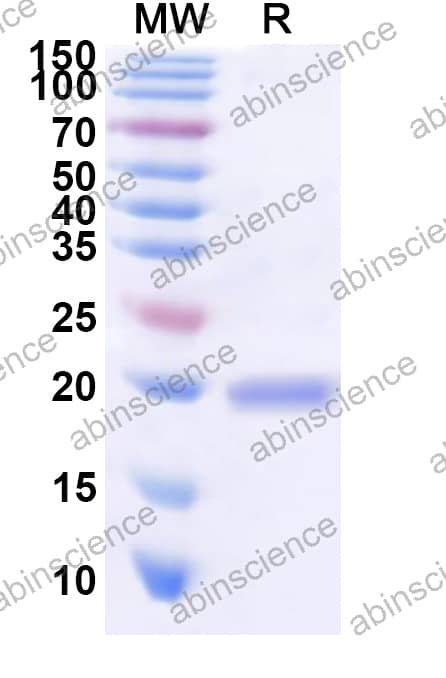 CPXV CrmD Recombinant Protein (N-His)