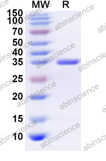 CPXV vCCI Recombinant Protein (N-His)