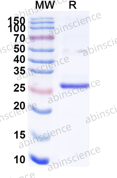 CPXV vCCI Recombinant Protein (C-His)