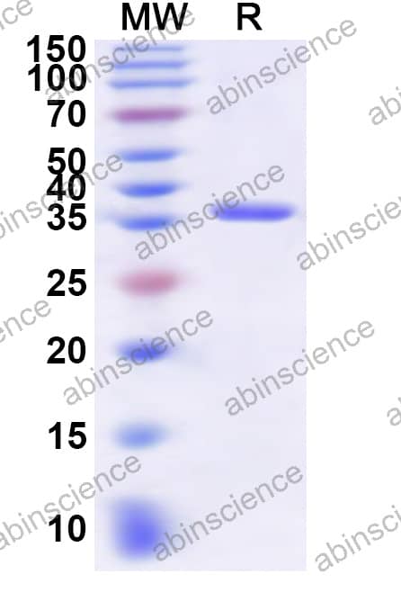 CPXV OPG199 Recombinant Protein (N-His)