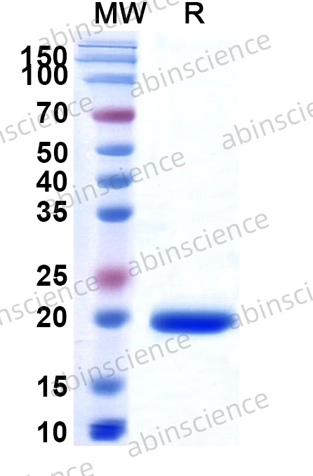 Recombinant MERS-CoV nsp1 Protein, N-His