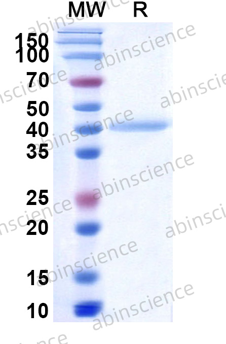 Recombinant MERS-CoV nsp2 Protein, N-His