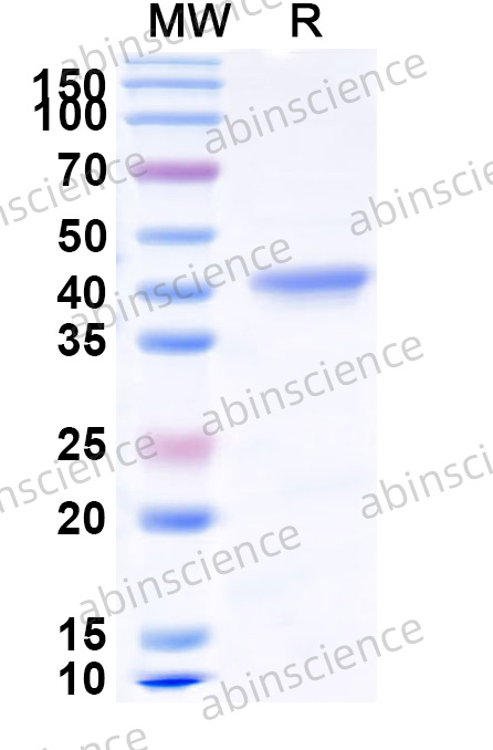 Recombinant MERS-CoV nsp3 Protein, N-His