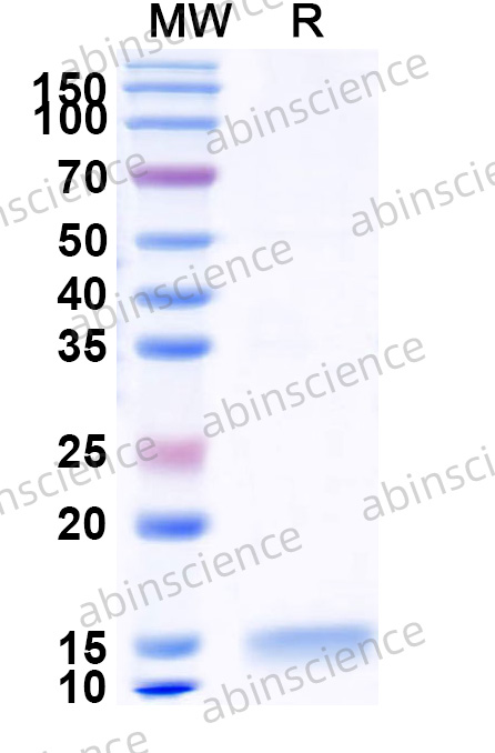 Recombinant MERS-CoV nsp4 Protein, N-His