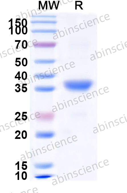 Recombinant MERS-CoV nsp5 Protein, N-His