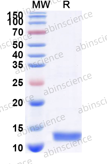 Recombinant MERS-CoV nsp7 Protein, N-His