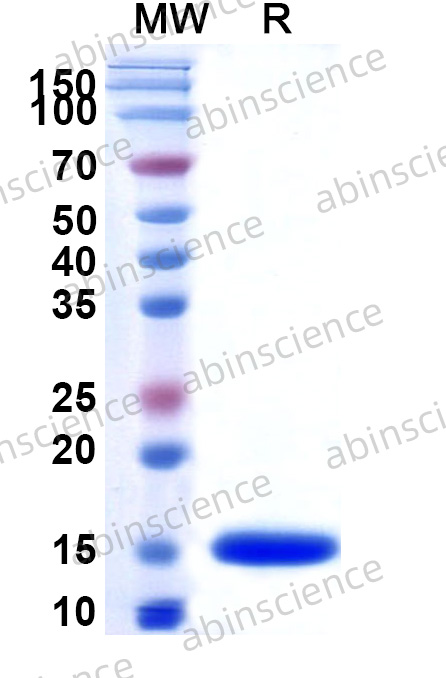 MERS-CoV Membrane Recombinant Protein (N-His)