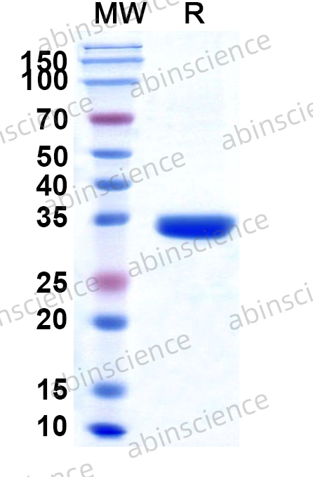 Recombinant MERS-CoV Envelope Protein, N-GST & C-His