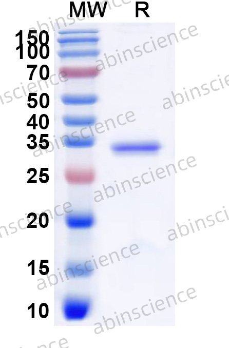 Recombinant MERS-CoV ORF4b Protein, N-His