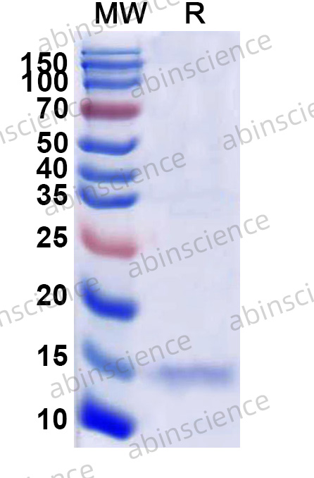 MERS-CoV ORF5 Recombinant Protein (N-His)