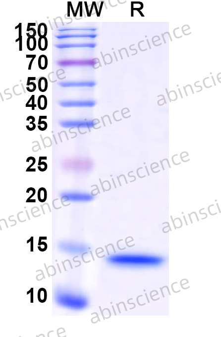 MERS-CoV ORF4a Recombinant Protein (N-His)
