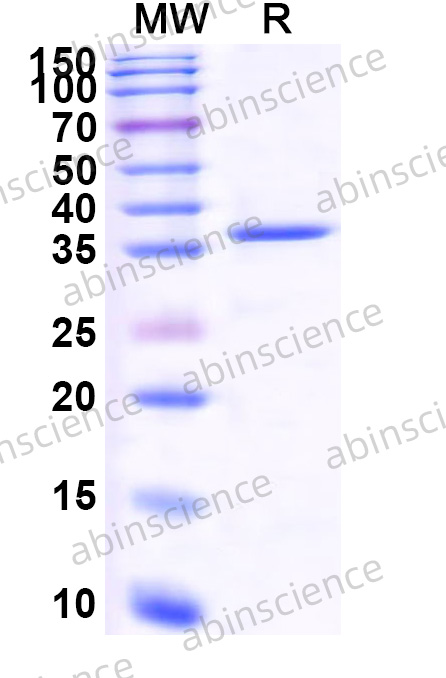 MERS-CoV ORF3 Recombinant Protein (N-GST & C-His)