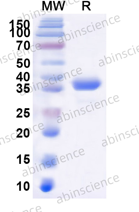 Recombinant EBV/HHV4 BMRF1 Protein, N-His