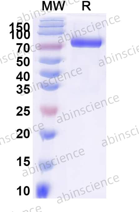 EHV-1 glycoprotein D/gD Recombinant Protein (C-Fc)