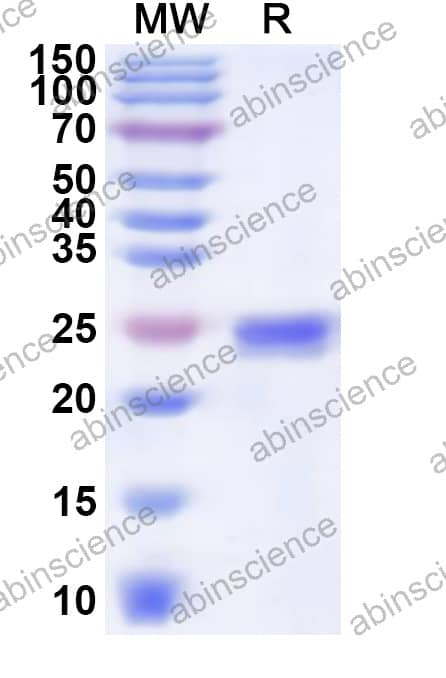 EHV-1 glycoprotein C/gC Recombinant Protein (N-His)
