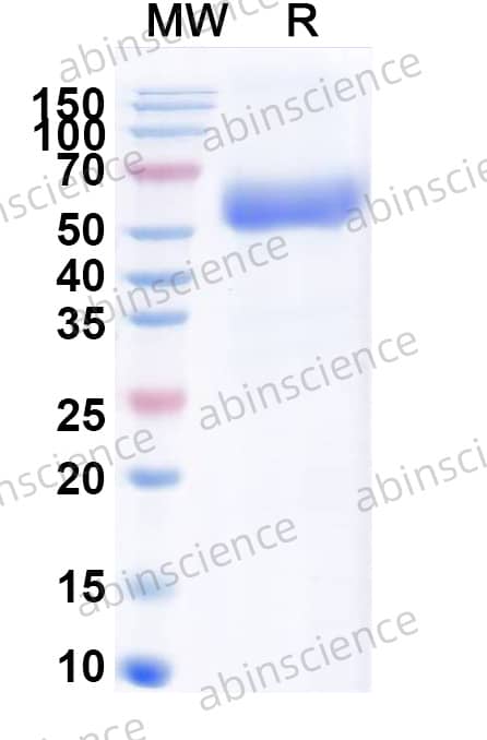 EHV-1 glycoprotein D/gD Recombinant Protein (C-His)