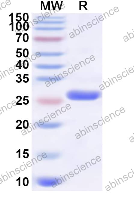 EHV-1 TRX1 Recombinant Protein (N-His)