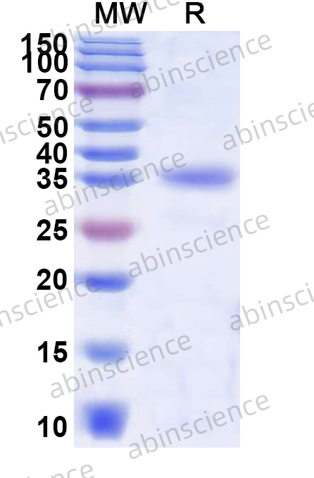 EHV-1 glycoprotein H/gH Recombinant Protein (N-His)