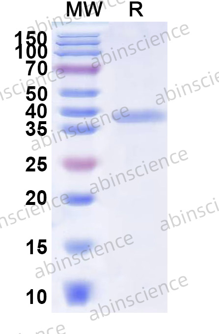 EHV-1 TRX2 Recombinant Protein (N-His)