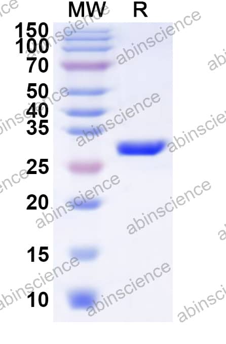 EHV-1 glycoprotein B/gB Recombinant Protein (N-His)