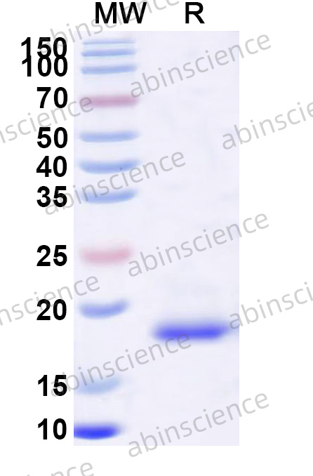 EHV-1 glycoprotein G/gG Recombinant Protein (N-His)