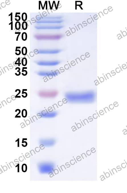 EHV-1 glycoprotein J/gJ Recombinant Protein (N-His)