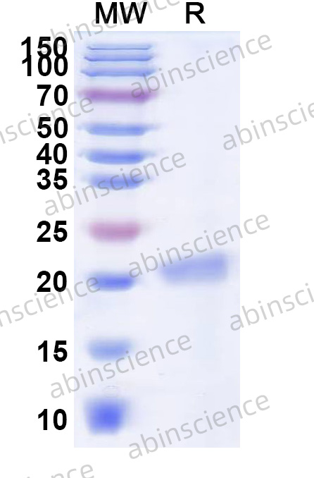 EHV-1 glycoprotein E/gE Recombinant Protein (N-His)