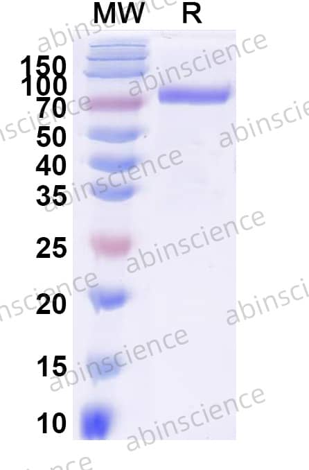 EHV-4 glycoprotein D/gD Recombinant Protein (C-Fc)