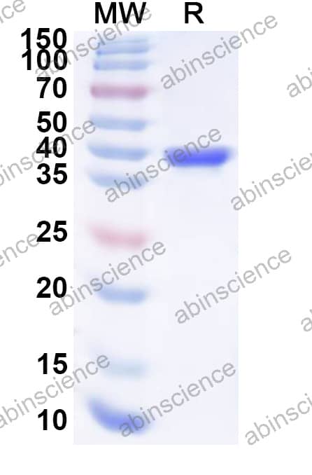 EHV-4 glycoprotein D/gD Recombinant Protein (N-His)