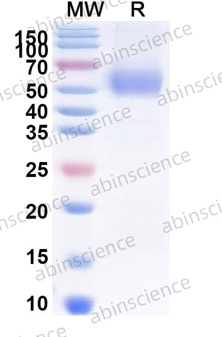 EHV-4 glycoprotein D/gD Recombinant Protein (C-His)