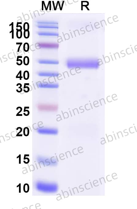 GaHV-2 glycoprotein L/gL Recombinant Protein (C-Fc)