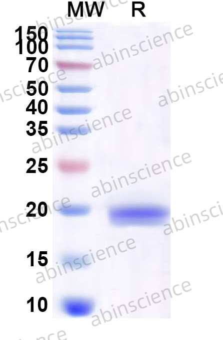 GaHV-2 MDV078/vIL8 Recombinant Protein (N-His)