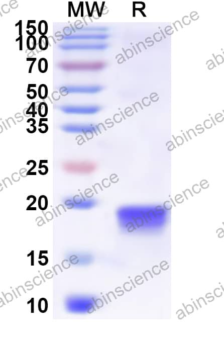 GaHV-2 MDV008/pp24 Recombinant Protein (N-His)
