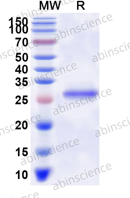 GaHV-2 MDV010/vLIP Recombinant Protein (N-His)