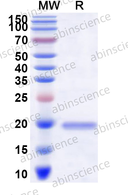 GaHV-2 glycoprotein L/gL Recombinant Protein (N-His)
