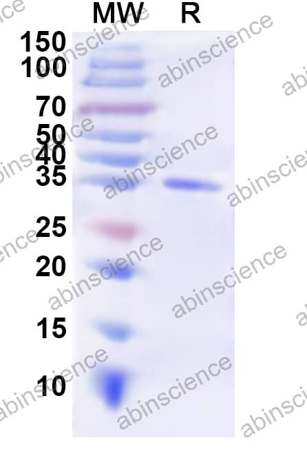 GaHV-2 glycoprotein B/gB Recombinant Protein (N-His)