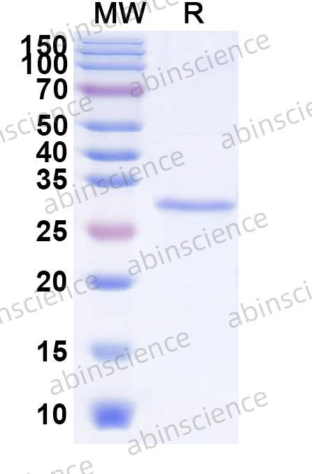 HAV VP2 Recombinant Protein (N-His)