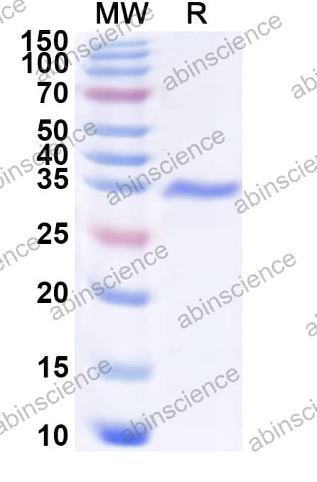 HHAV VP1 Recombinant Protein (N-His)