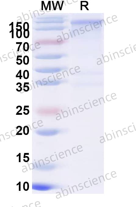 HSV1/HHV-1 glycoprotein H/gH Recombinant Protein (C-Fc)