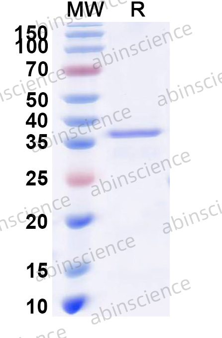 HSV1/HHV-1 glycoprotein H/gH Recombinant Protein (N-His)