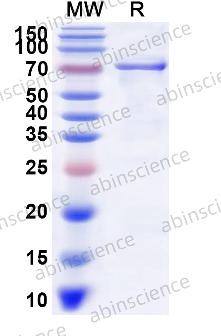 HSV-2/HHV-2 glycoprotein H/gH Recombinant Protein (N-His)