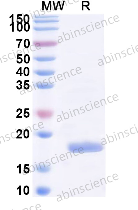 HSV1/HHV-1 glycoprotein I/gI Recombinant Protein (N-His)